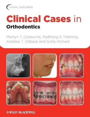 Clinical Cases in Orthodontics - Martyn T. Cobourne, Padhraig S. Fleming, Andrew T. DiBiase, Sofia Ahmad