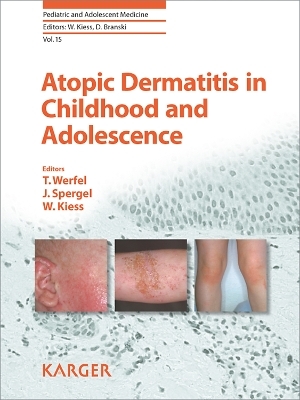 Atopic Dermatitis in Childhood and Adolescence - 