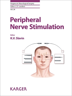 Peripheral Nerve Stimulation - 