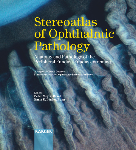 Stereoatlas of Ophthalmic Pathology - 