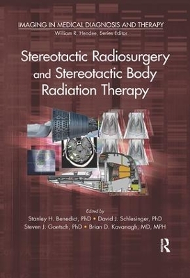 Stereotactic Radiosurgery and Stereotactic Body Radiation Therapy - 