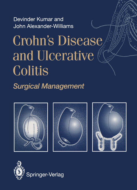 Crohn’s Disease and Ulcerative Colitis - Devinder Kumar, John Alexander-Williams