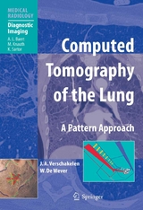 Computed Tomography of the Lung - Johny A. Verschakelen, Walter de Wever