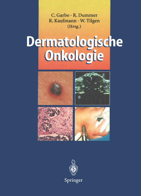 Dermatologische Onkologie - 