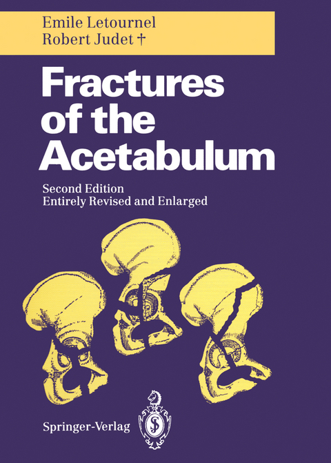 Fractures of the Acetabulum - Emile Letournel, Robert Judet