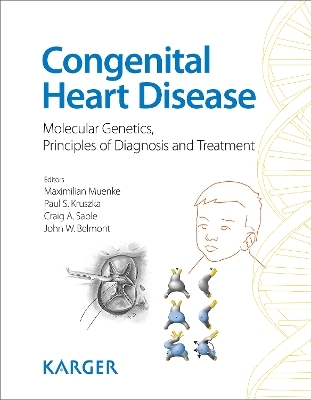 Congenital Heart Disease - 