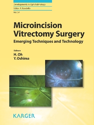 Microincision Vitrectomy Surgery - 