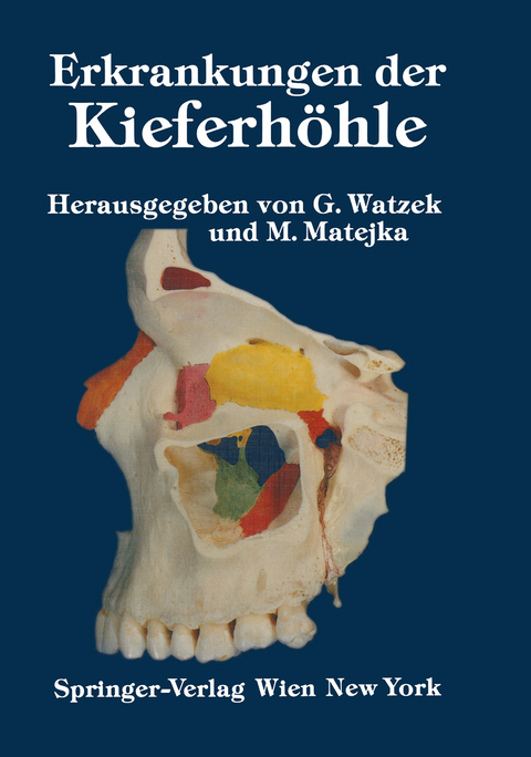 Erkrankungen der Kieferhöhle - 