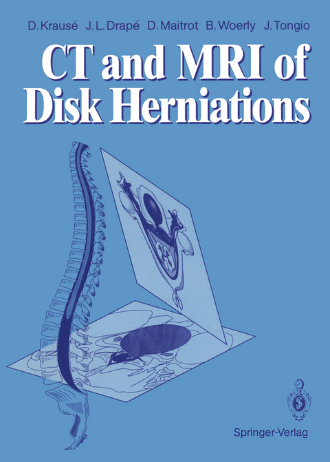 CT and MRI of Disk Herniations - Denis Krause, Jean L. Drape, Daniel Maitrot, Bernard Woerly, Jean Tongio