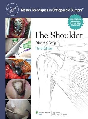 Master Techniques in Orthopaedic Surgery: Shoulder - Edward V Craig