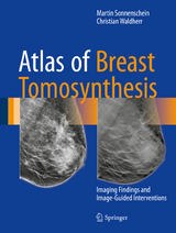 Atlas of Breast Tomosynthesis - Martin Sonnenschein, Christian Waldherr