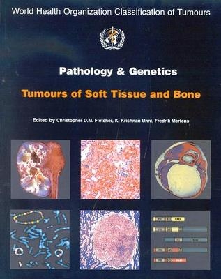 Pathology and Genetics of Tumours of Soft Tissue and Bone - 