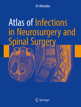 Atlas of Infections in Neurosurgery and Spinal Surgery - Ali Akhaddar