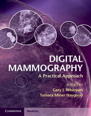 Digital Mammography - 