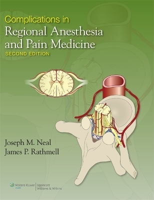 Complications in Regional Anesthesia and Pain Medicine - Joseph Neal, James P. Rathmell