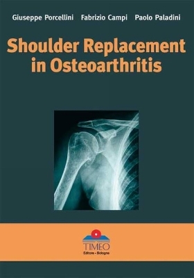 Shoulder Replacement in Osteoarthritis - Giuseppe Porcellini