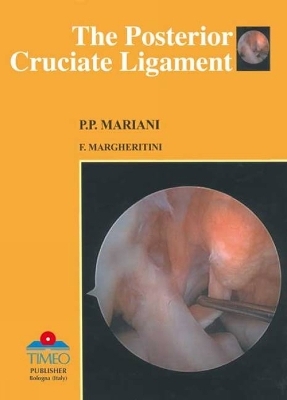 Posterior Cruciate Ligament - Pier Paolo Mariani