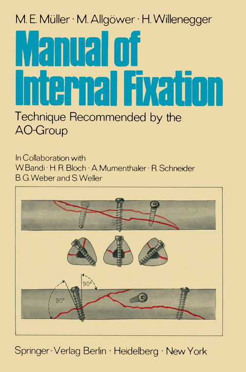 Manual of Internal Fixation - M. E. Müller, M. Allgöwer, H. Willenegger