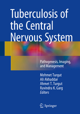 Tuberculosis of the Central Nervous System - 