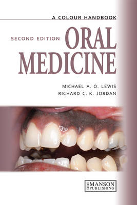 Oral Medicine, Second Edition - Michael A.O. Lewis, Richard C.K. Jordan