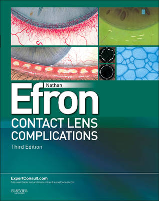 Contact Lens Complications - Nathan Efron