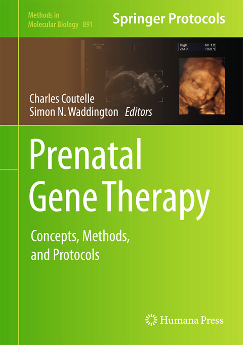 Prenatal Gene Therapy - 