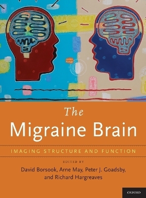 The Migraine Brain - 