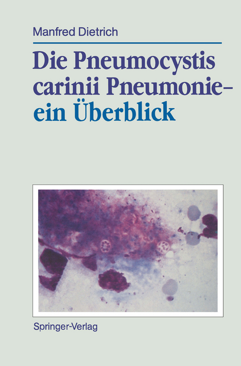 Die Pneumocystis carinii Pneumonie— ein Überblick - Manfred Dietrich