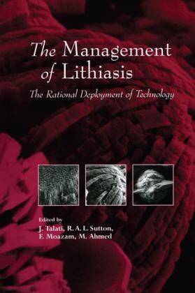 The Management of Lithiasis - 