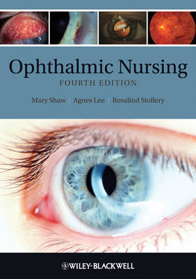 Ophthalmic Nursing - ME Shaw