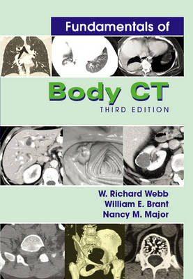 Fundamentals of Body CT - W.Richard Webb, William E. Brant, Nancy M. Major