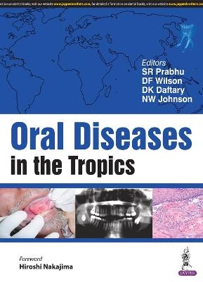 Oral Diseases in the Tropics - S R Prabhu, D F Wilson, D K Daftary, N W Johnson