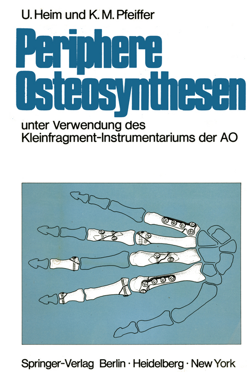 Periphere Osteosynthesen - Urs Heim, Karl M. Pfeiffer