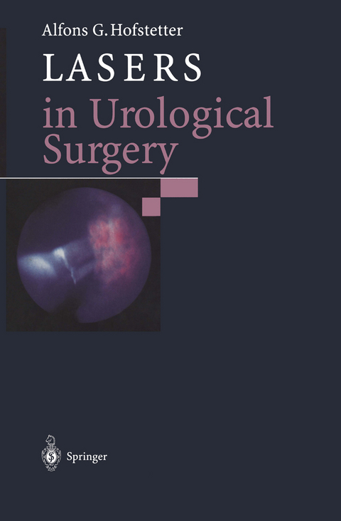 Lasers in Urological Surgery - 