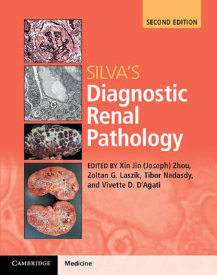 Silva's Diagnostic Renal Pathology - 