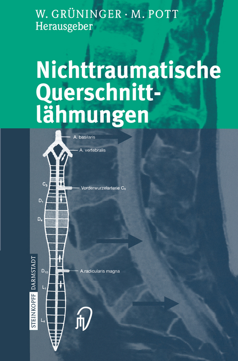 Nichttraumatische Querschnittlähmungen - 