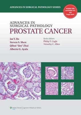 Advances in Surgical Pathology: Prostate Cancer - Dr. Jae Y. Ro, Steven S. Shen, Dr. Qihui "Jim" Zhai, Alberto G. Ayala