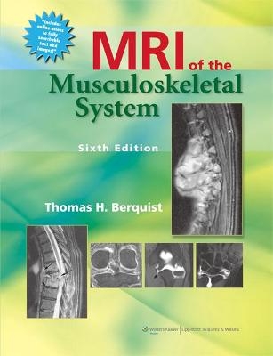 MRI of the Musculoskeletal System - Thomas H. Berquist