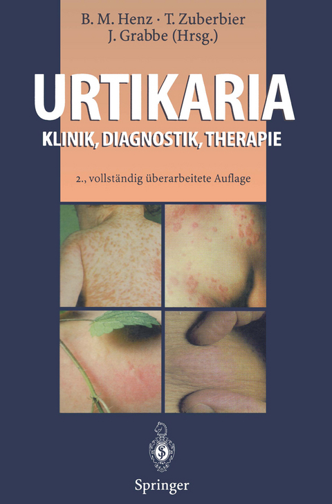 Urtikaria - 