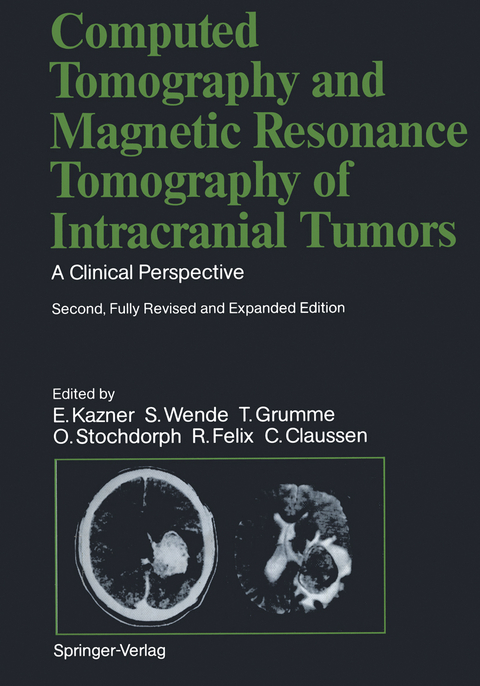 Computed Tomography and Magnetic Resonance Tomography of Intracranial Tumors - C. Claussen, R. Fahlbusch, R. Felix, T. Grumme, J. Heinzerling, J.R. Iglesias-Rozas, E. Kazner, K. Kretzschmar, M. Laniado, W. Lanksch, W. Müller-Forell, T.H. Newton, W. Schörner, G. Schroth, B. Schulz, O. Stochdorph, G. Sze, S. Wende