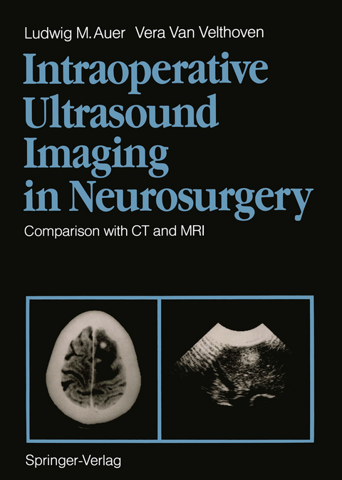 Intraoperative Ultrasound Imaging in Neurosurgery - Ludwig M. Auer, Vera van Velthoven