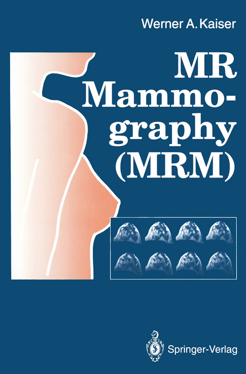 MR Mammography (MRM) - Werner A. Kaiser