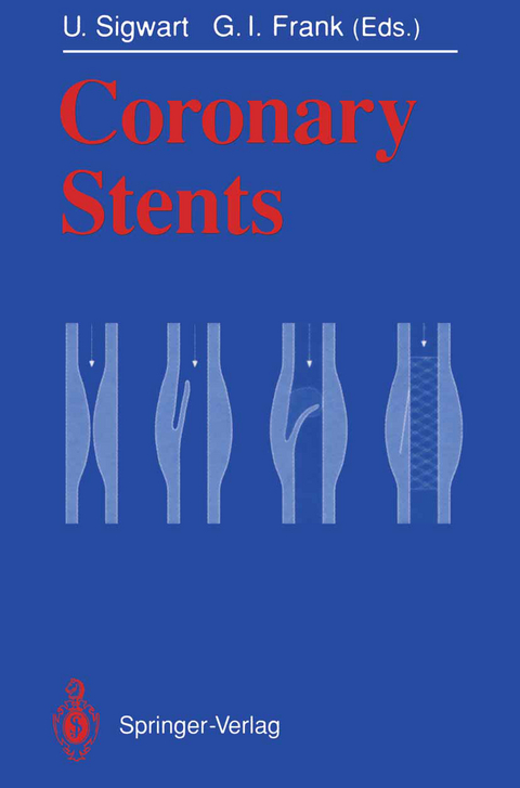 Coronary Stents - 