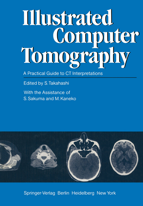 Illustrated Computer Tomography - 