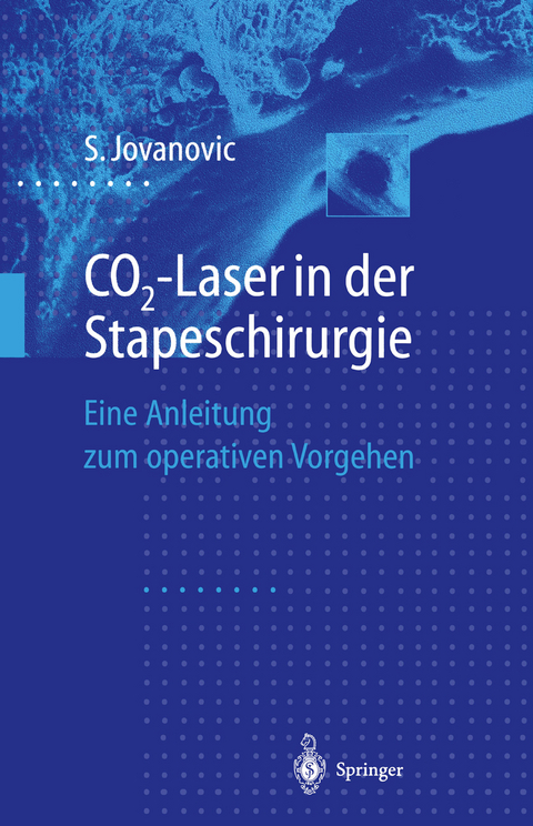 CO2-Laser in der Stapeschirurgie - Sergije Jovanovic