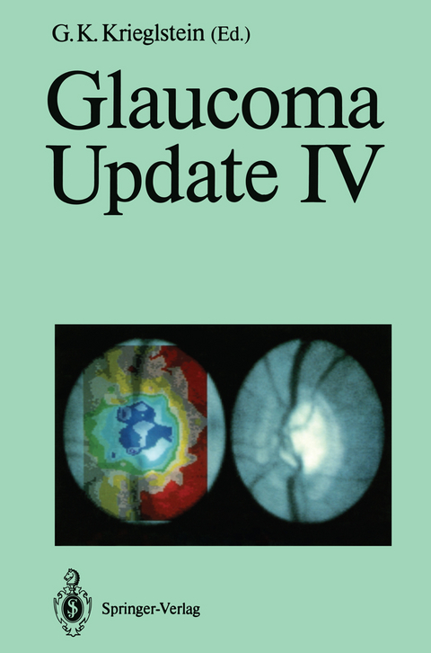 Glaucoma Update IV - 