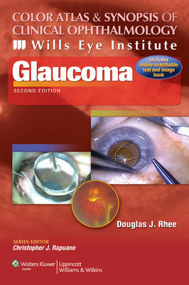 Color Atlas and Synopsis of Clinical Ophthalmology -- Wills Eye Institute -- Glaucoma - Douglas J. Rhee