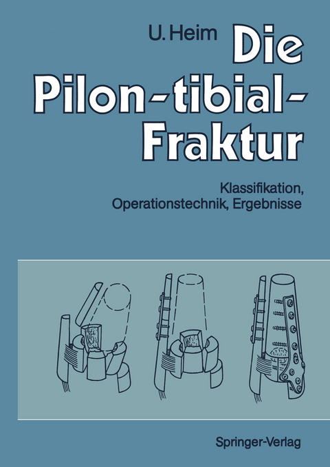 Die Pilon-tibial-Fraktur - Urs Heim