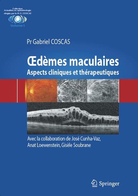 Demes Maculaires - Gabriel Coscas