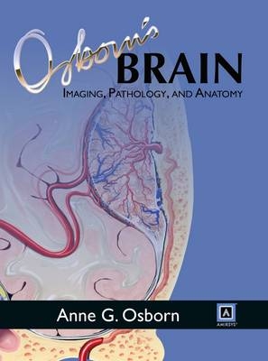 Osborn's Brain: Imaging, Pathology, and Anatomy - Anne G. Osborn